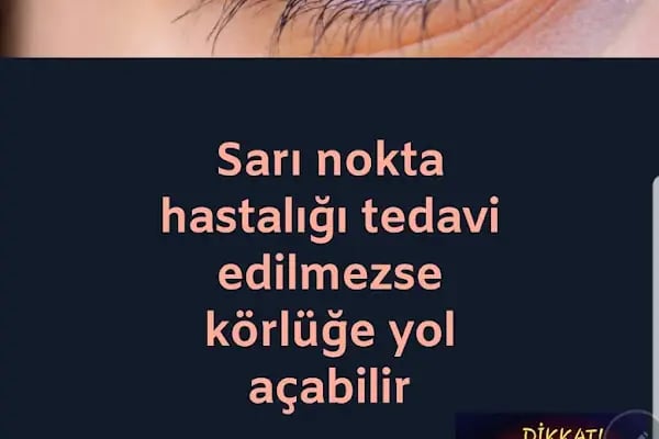 Göz Hastalıkları Uzmanı Prof. Dr. Sema Oruç Dündar - Resim 12