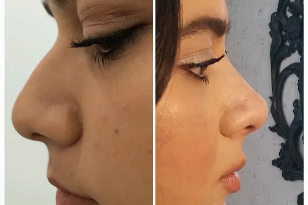 Dr. İlker Yörük medikal estetik kliniği - Resim 8