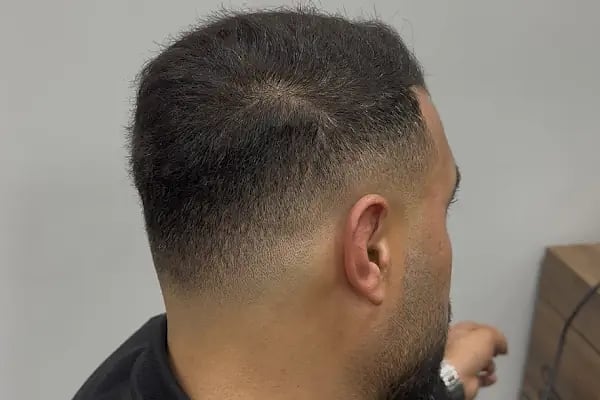 Halit Kurt Barber - Resim 9