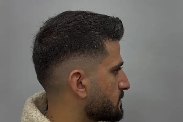 Halit Kurt Barber - Resim 8