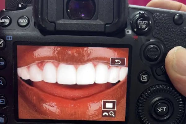 Amazing Smile Turkey - Resim 12