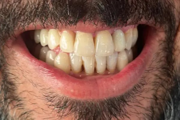 Amazing Smile Turkey - Resim 11