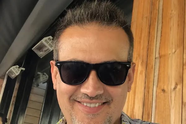 Bursa Burun Estetiği Op. Dr. Önder Akdeniz - Resim 18