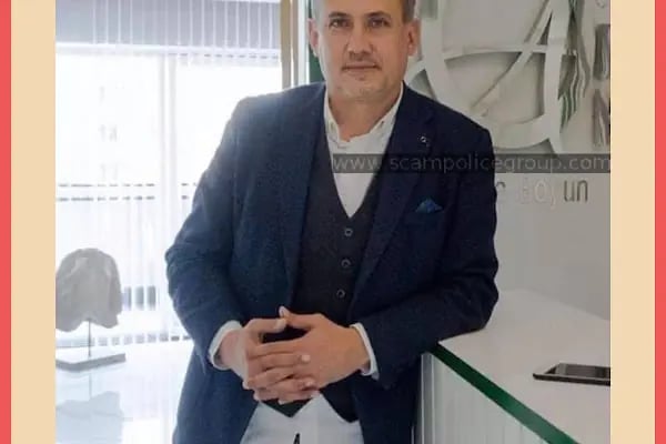 Bursa Burun Estetiği Op. Dr. Önder Akdeniz - Resim 3