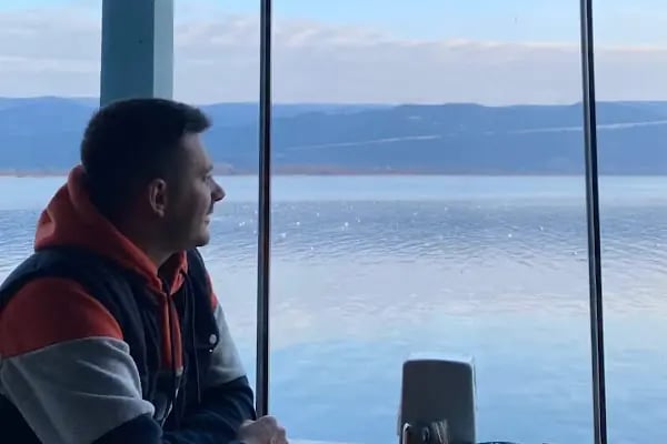 Bursa Burun Estetiği Op. Dr. Önder Akdeniz - Resim 19