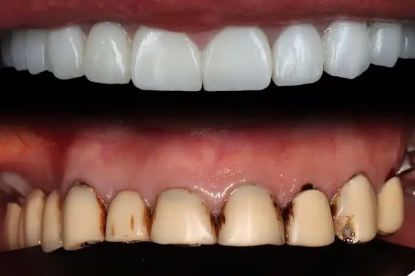 Diş Hekimi Mehmet ARIKAN - Resim 8