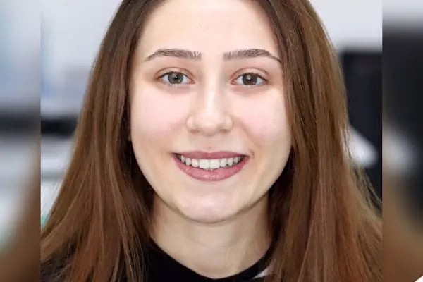 Diş Hekimi Mehmet ARIKAN - Resim 10
