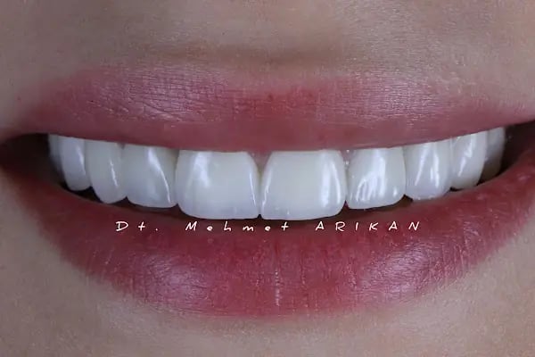 Diş Hekimi Mehmet ARIKAN - Resim 2