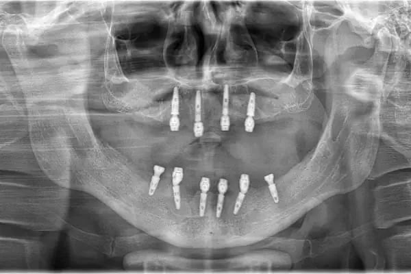 Dentalisa Clinic Ağız ve Diş Sağlığı Polikliniği - Resim 3