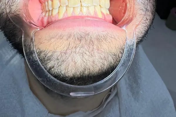 Vita Konak ZDENT Ağız ve Diş Sağlığı - Resim 2