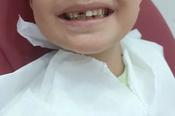 Pena Dent Ağız ve Diş Sağlığı Polikliniği - Resim 19