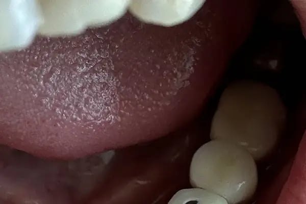 Tunalı Dental Akademi Ağız ve Diş Sağlığı Polikliniği - Resim 18