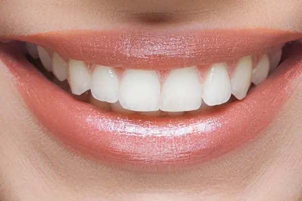 Tunalı Dental Akademi Ağız ve Diş Sağlığı Polikliniği - Resim 12