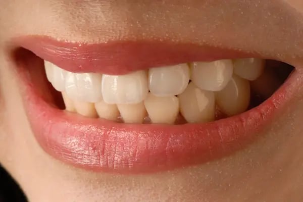 Uzm.Dr. Berk EROL | Çene Cerrahisi ve İmplant Kliniği - Resim 6