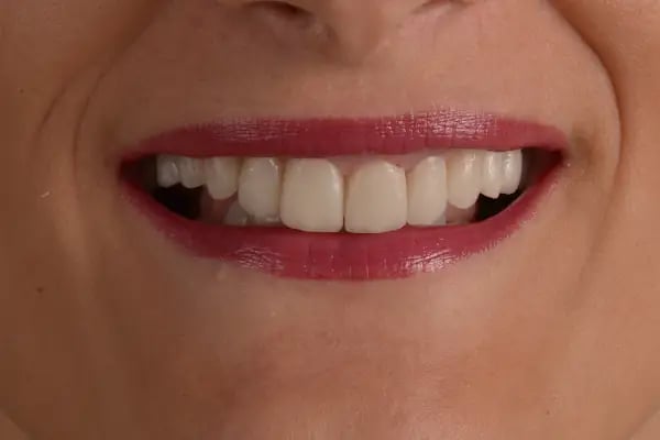 Diş Hekimi Alper ŞENYÜZ - Resim 6