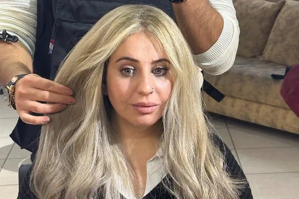 Erkan Dizici Hair Design saç kaynak merkezi - Resim 10