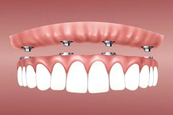 Alanya Dental Place - Dt. Selim Mert Şahinkaya - Resim 10