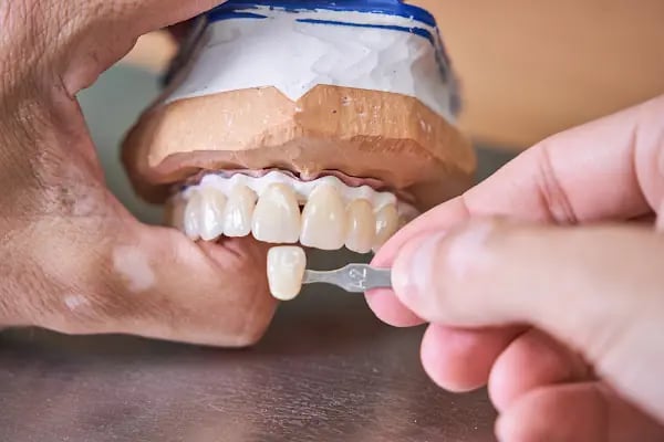 Alanya Dental Place - Dt. Selim Mert Şahinkaya - Resim 12