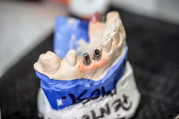 Alanya Dental Place - Dt. Selim Mert Şahinkaya - Resim 8
