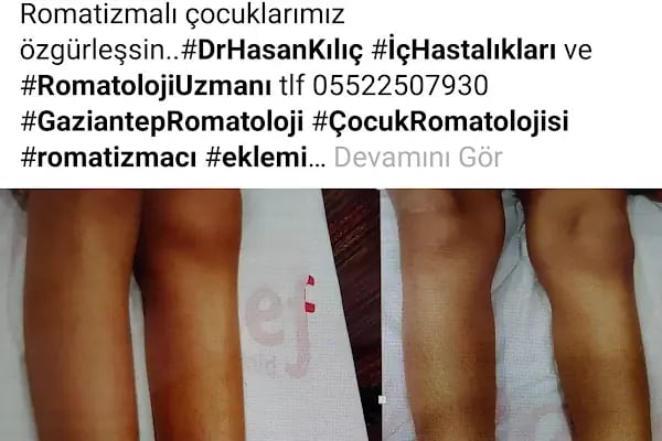 Dr. Hasan Kılıç Romatoloji Kliniği - Resim 8
