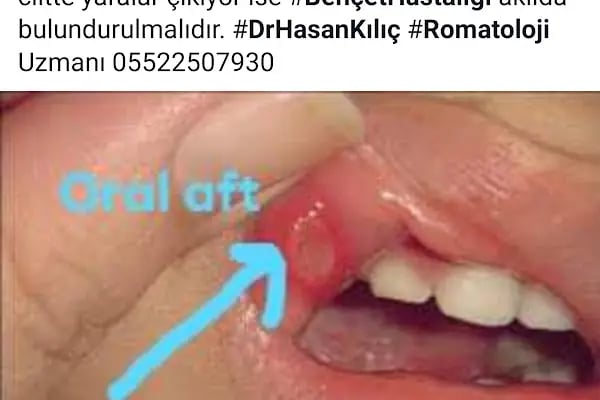 Dr. Hasan Kılıç Romatoloji Kliniği - Resim 16