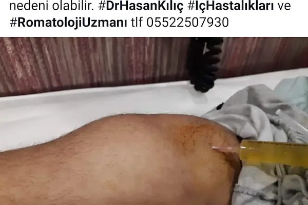 Dr. Hasan Kılıç Romatoloji Kliniği - Resim 11