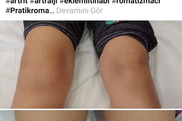 Dr. Hasan Kılıç Romatoloji Kliniği - Resim 13