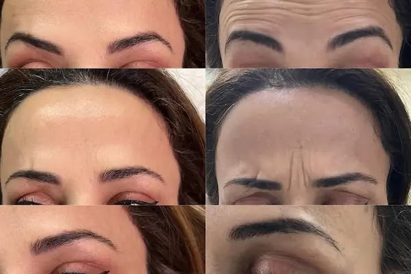 Aura Bella Klinik ve Güzellik Gaziantep - Resim 8