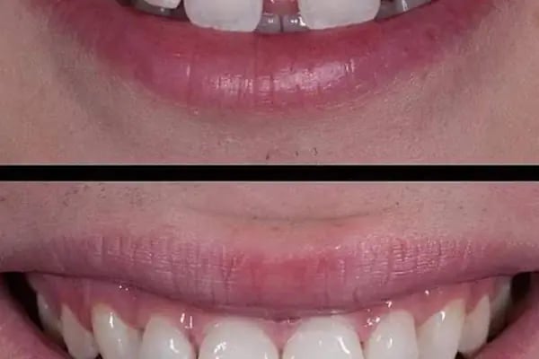 Estetica Dent all safa hast.yan sokağı bağcılar acil diş zirkon Safa diş - Resim 2