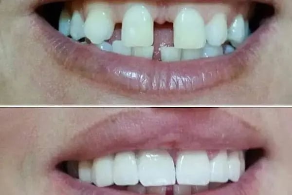 Estetica Dent all safa hast.yan sokağı bağcılar acil diş zirkon Safa diş - Resim 20