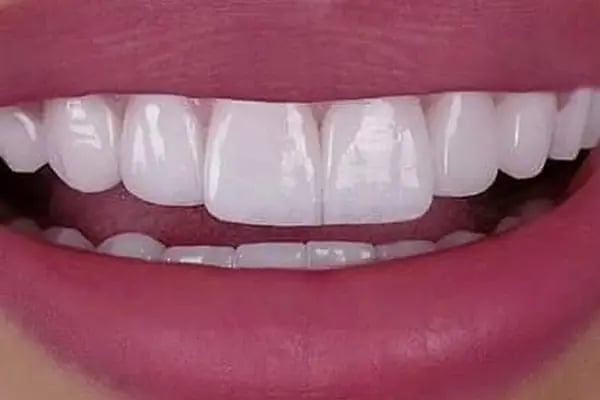 Estetica Dent all safa hast.yan sokağı bağcılar acil diş zirkon Safa diş - Resim 4