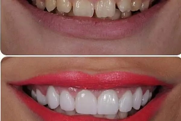 Estetica Dent all safa hast.yan sokağı bağcılar acil diş zirkon Safa diş - Resim 19