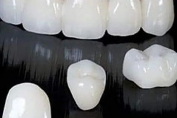 Estetica Dent all safa hast.yan sokağı bağcılar acil diş zirkon Safa diş - Resim 16