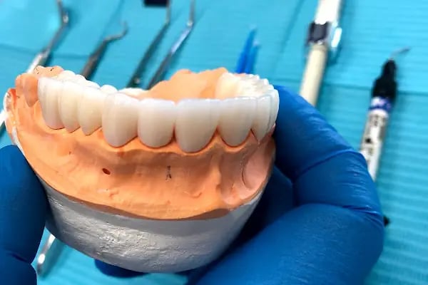 BatıKlinik Ağız ve Diş Sağlığı Polikliniği - Protez Uzmanı, Batıkent İmplant Tedavisi, Batıkent Diş Hekimi - Resim 6