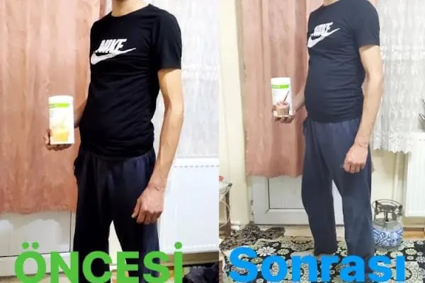 Natural Life Aktif Yaşam ve Kilo Kontrol Merkezi - Resim 9