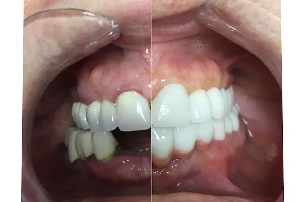 Özel Dent İzmirim Ağız Ve Diş Sağlığı Polikliniği - Resim 20