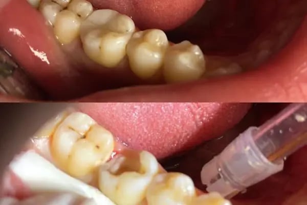 Özel Dent İzmirim Ağız Ve Diş Sağlığı Polikliniği - Resim 19