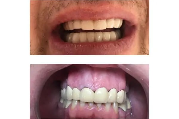 Özel Dent İzmirim Ağız Ve Diş Sağlığı Polikliniği - Resim 18