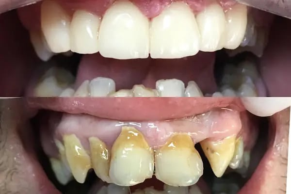 Özel Dent İzmirim Ağız Ve Diş Sağlığı Polikliniği - Resim 14