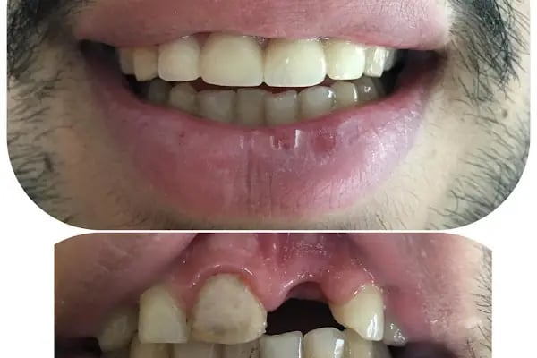 Özel Dent İzmirim Ağız Ve Diş Sağlığı Polikliniği - Resim 12