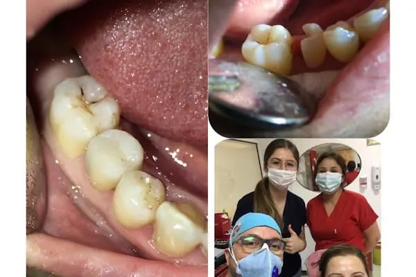 Özel Dent İzmirim Ağız Ve Diş Sağlığı Polikliniği - Resim 15