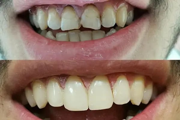 Özel Dent İzmirim Ağız Ve Diş Sağlığı Polikliniği - Resim 13