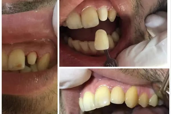 Özel Dent İzmirim Ağız Ve Diş Sağlığı Polikliniği - Resim 17
