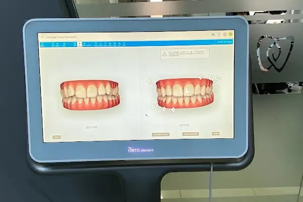 Özel Nisan Ağız ve Diş Sağlığı Polikliniği - Resim 9