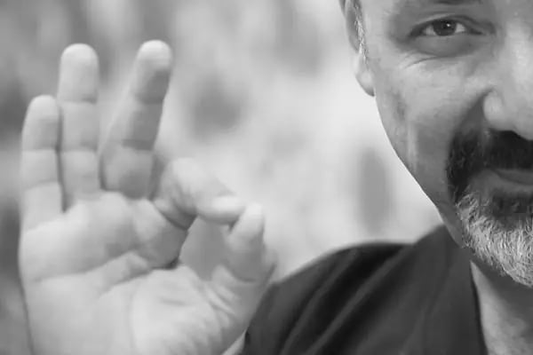 Civas&amp;Akpınar Hair Transplant Center Turkey - Resim 8