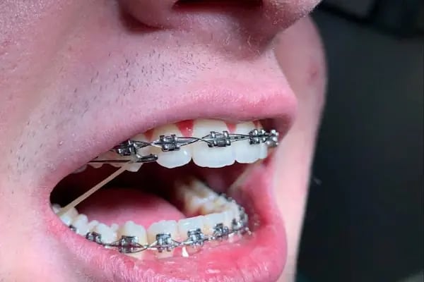 Mandarindent - Dental Clinic in Bodrum, Turkey- Dental Treatments -Dental Implant- Cosmetic Dentistry - Resim 4