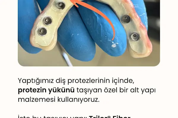 Mardin RoDent Ağız ve Diş Sağlığı Merkezi - Resim 6
