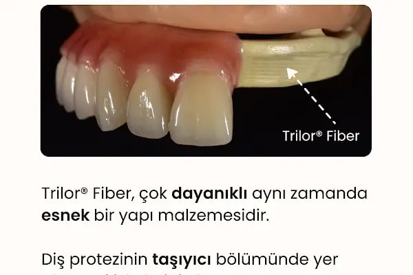 Mardin RoDent Ağız ve Diş Sağlığı Merkezi - Resim 8