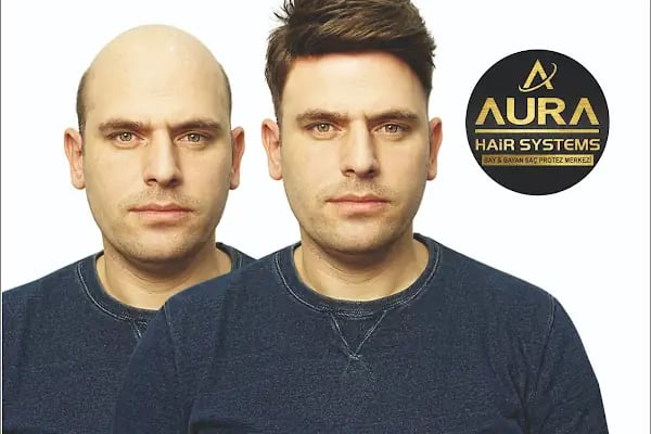 Aurahair protez saç merkezi - Resim 1