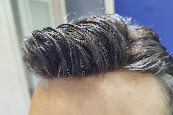 Aurahair protez saç merkezi - Resim 8